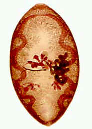 肺吸虫.jpg (18378 字节)