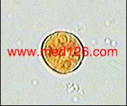溶包碘1.jpg (8313 字节)